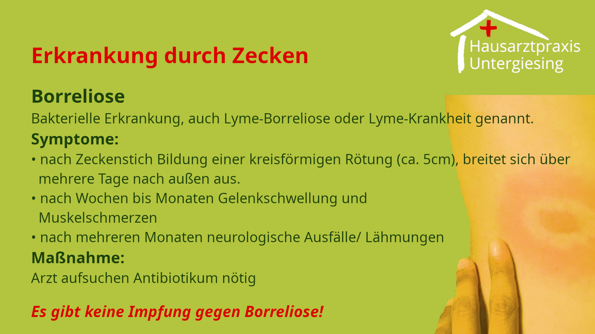 Erkrankung Borreliose